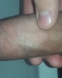 photo-thumb