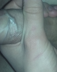 photo-thumb