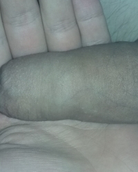 photo-thumb