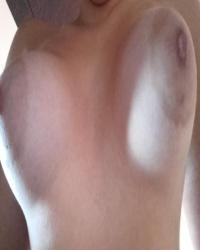 photo-thumb