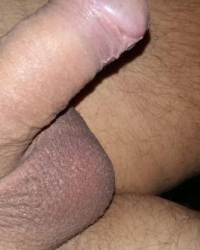 photo-thumb
