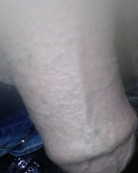 photo-thumb