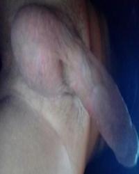 photo-thumb