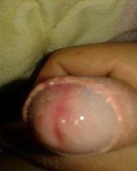 photo-thumb