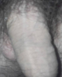photo-thumb
