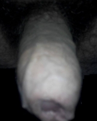 photo-thumb