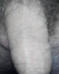 photo-thumb
