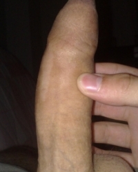 photo-thumb