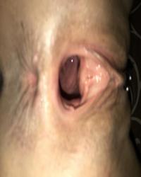 photo-thumb