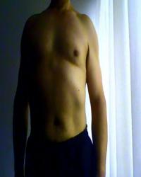 photo-thumb