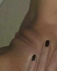 photo-thumb