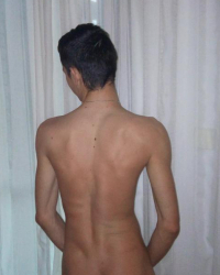 photo-thumb