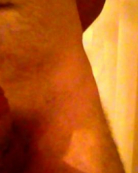 photo-thumb