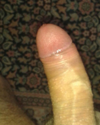 photo-thumb