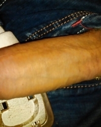 photo-thumb