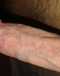 photo-thumb