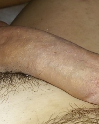 photo-thumb
