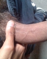 photo-thumb