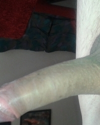 photo-thumb
