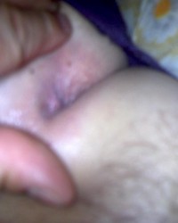 photo-thumb