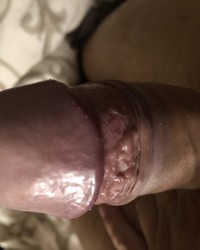 photo-thumb