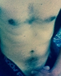 photo-thumb