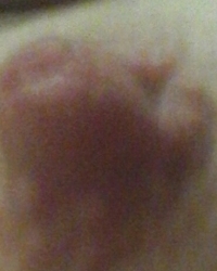 photo-thumb