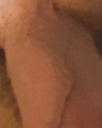 photo-thumb
