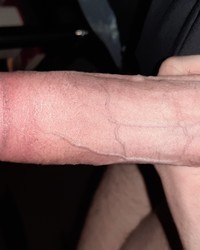 photo-thumb