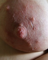 photo-thumb