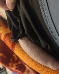 photo-thumb