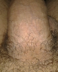 photo-thumb