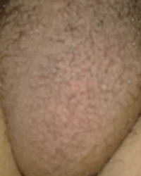 photo-thumb