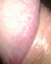 photo-thumb