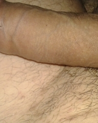 photo-thumb