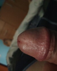 photo-thumb