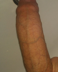 photo-thumb