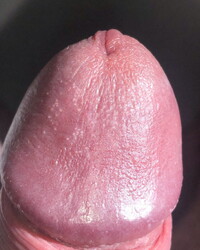 photo-thumb