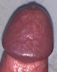 photo-thumb
