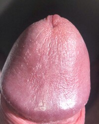 album-cover