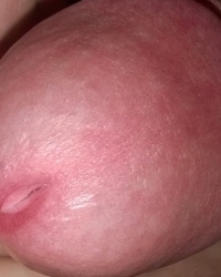 photo-thumb