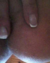 photo-thumb