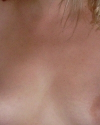 photo-thumb