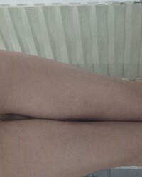 photo-thumb
