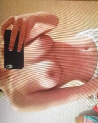 photo-thumb