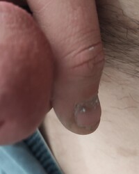 photo-thumb