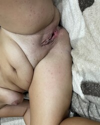 photo-thumb