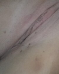 photo-thumb