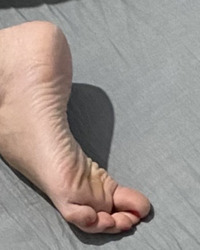 photo-thumb