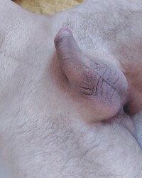 photo-thumb
